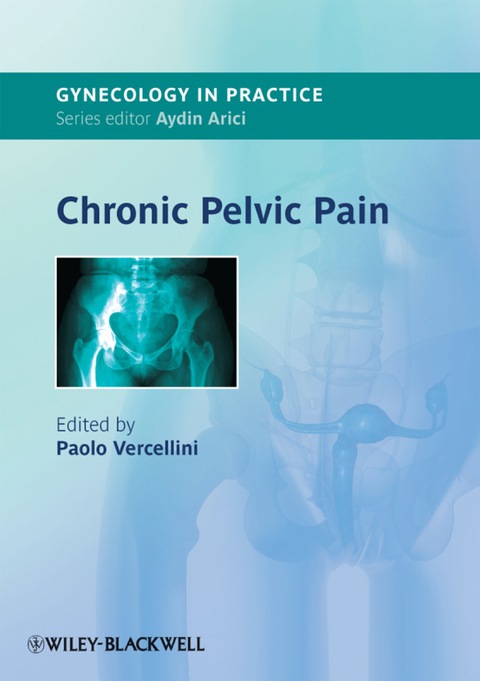 Cover image for book Chronic Pelvic Pain