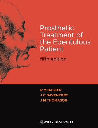 Prosthetic Treatment of the Edentulours Patient