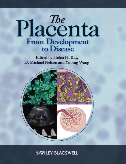 The Placenta: From Development to Disease 