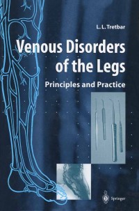 Titelbild: Venous Disorders of the Legs 9781852330071