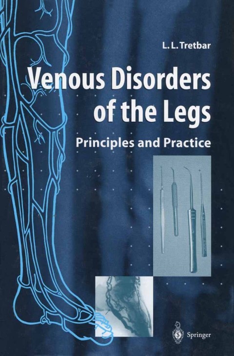Venous Disorders of the Legs 