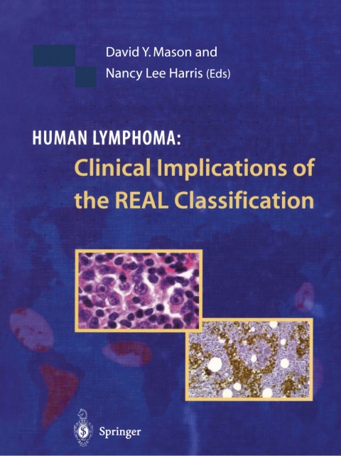 Cover image for book Human Lymphoma: Clinical Implications of the REAL Classification