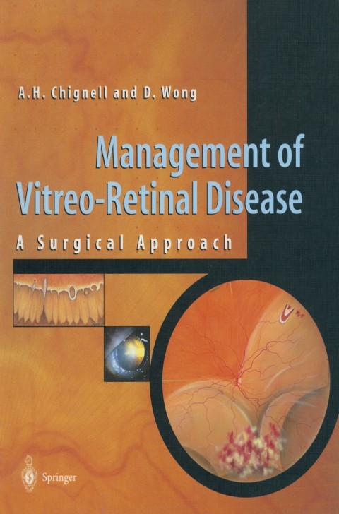 Management of Vitreo-Retinal Disease 