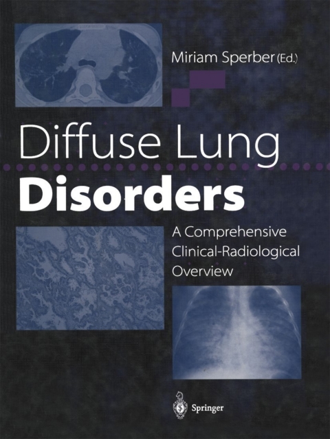 Cover image for book Diffuse Lung Disorders