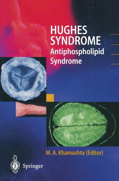 Cover image for book Hughes Syndrome