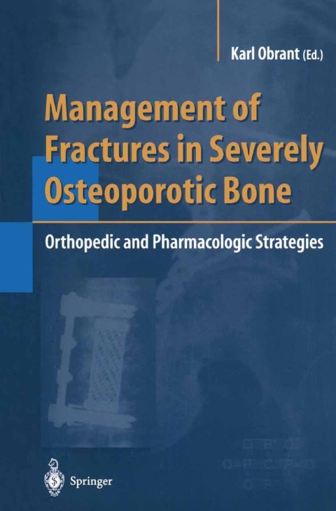 Cover image for book Management of Fractures in Severely Osteoporotic Bone