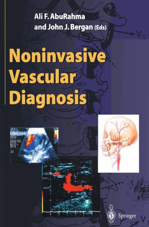 Cover image for book Noninvasive Vascular Diagnosis