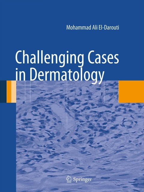 Cover image for book Challenging Cases in Dermatology
