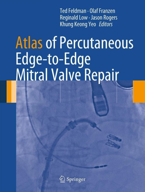 Cover image for book Atlas of Percutaneous Edge-to-Edge Mitral Valve Repair