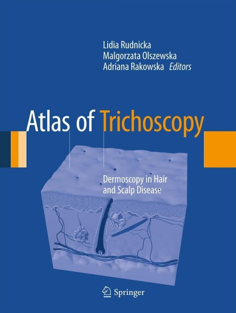 Cover image for book Atlas of Trichoscopy