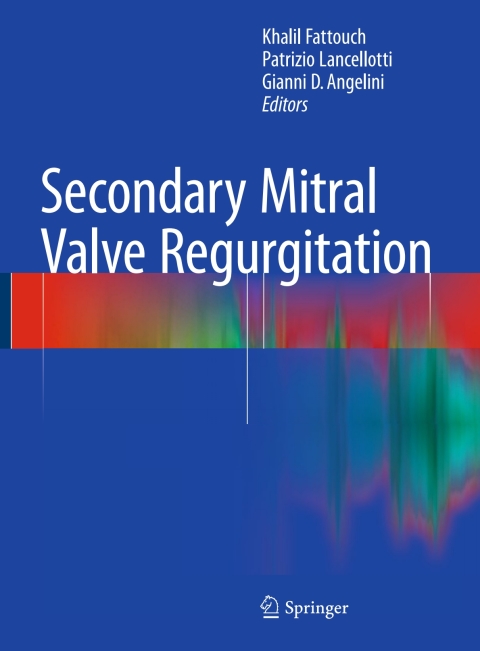 Cover image for book Secondary Mitral Valve Regurgitation
