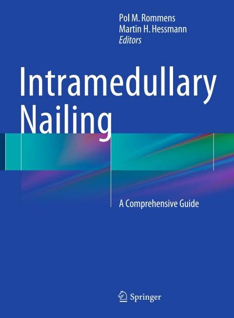 Cover image for book Intramedullary Nailing