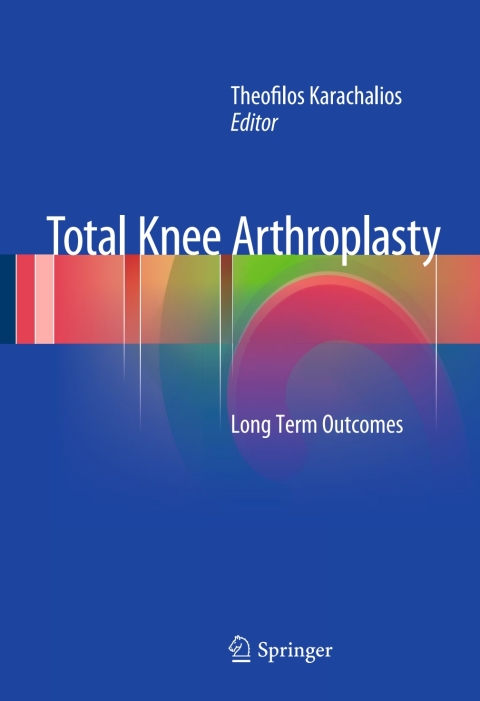 Cover image for book Total Knee Arthroplasty