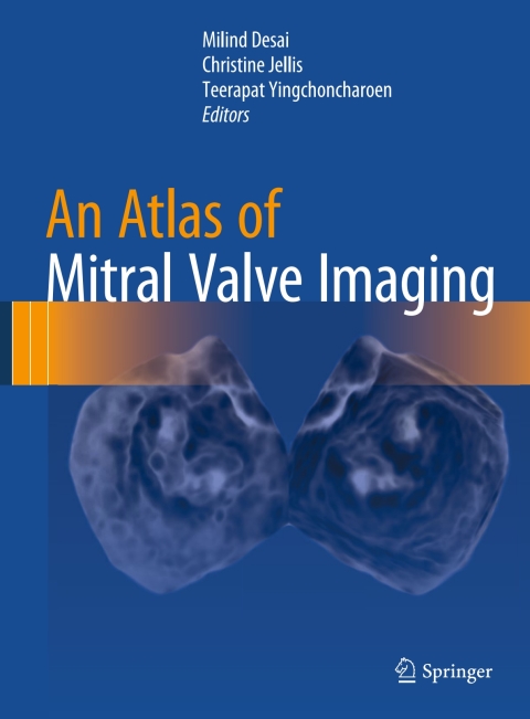 Cover image for book An Atlas of Mitral Valve Imaging