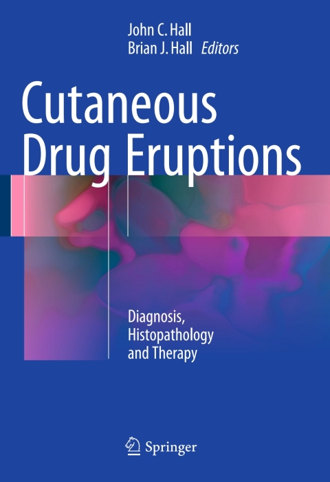 Cutaneous Drug Eruptions 