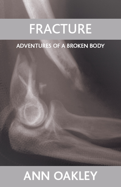 Cover image for book Fracture