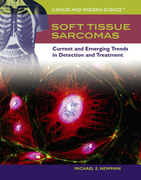 Cover image for book Soft Tissue Sarcomas