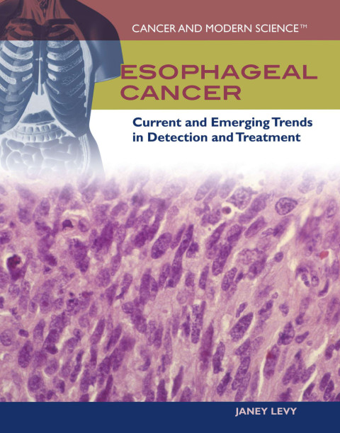 Cover image for book Esophageal Cancer