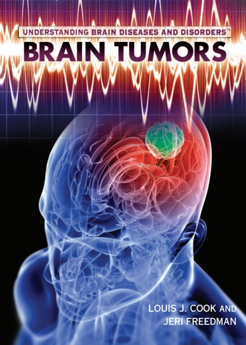 Cover image for book Brain Tumors