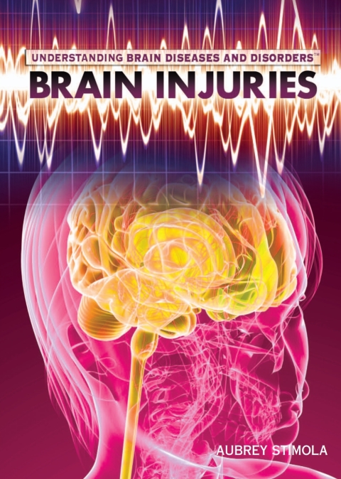 Cover image for book Brain Injuries