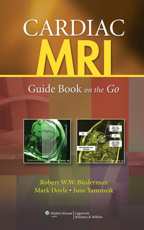 Cover image for book Cardiac MRI: Guide Book on the Go