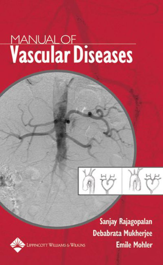 Manual of Vascular Diseases