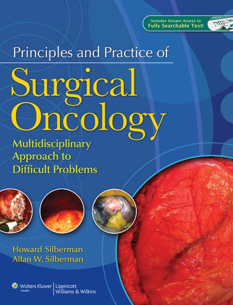 Cover image for book Principles and Practice of Surgical Oncology:  A Multidisciplinary Approach to Difficult Problems