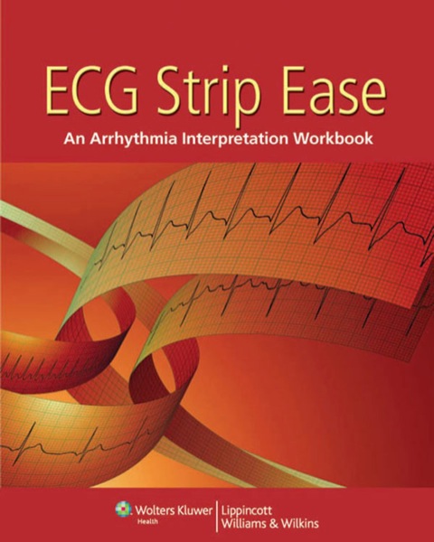 Cover image for book ECG Strip Ease