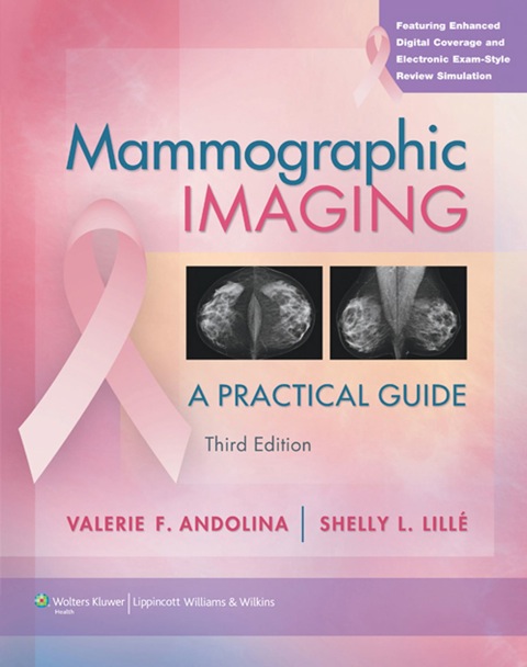Cover image for book Mammographic Imaging: A Practical Approach