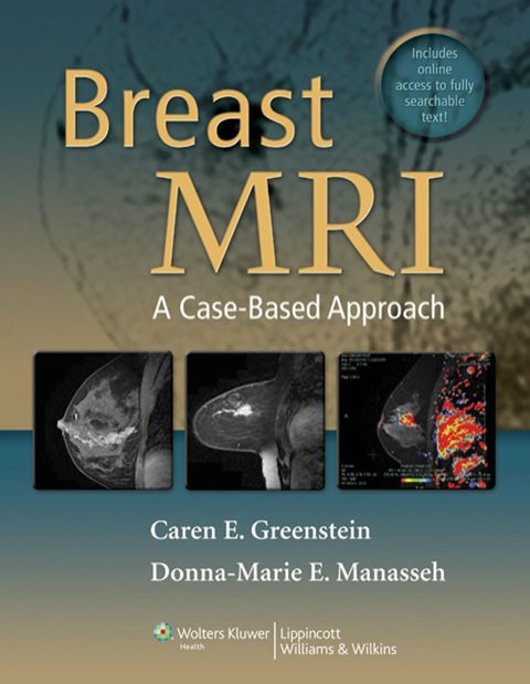 Cover image for book Breast MRI
