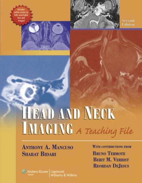 Cover image for book Head and Neck Imaging (LWW Teaching File Series)