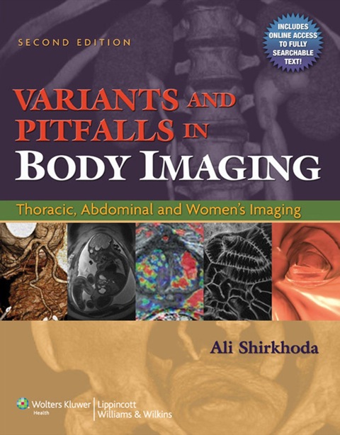 Cover image for book Variants and Pitfalls in Body Imaging