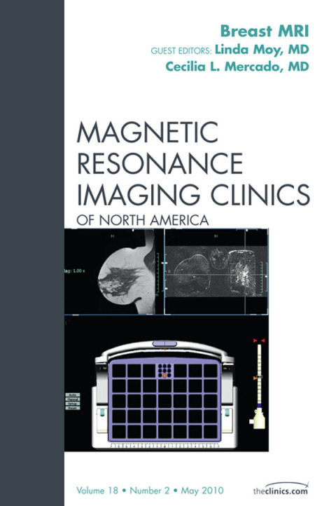 Cover image for book Breast MRI, An Issue of Magnetic Resonance Imaging Clinics