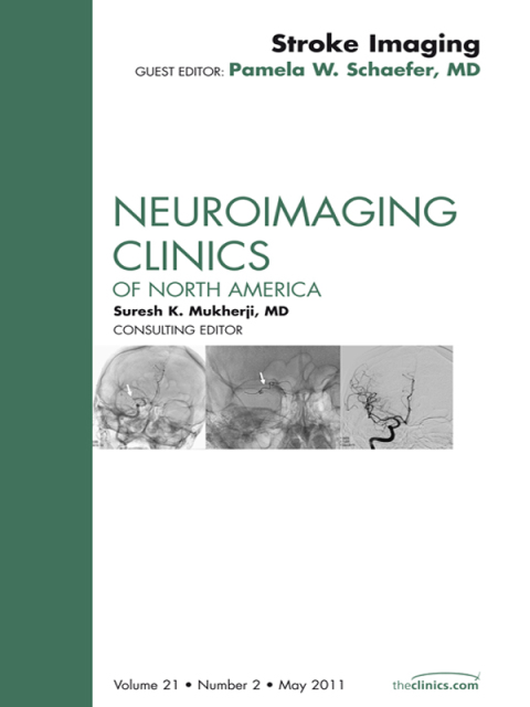 Cover image for book Stroke Imaging Update, An Issue of Neuroimaging Clinics