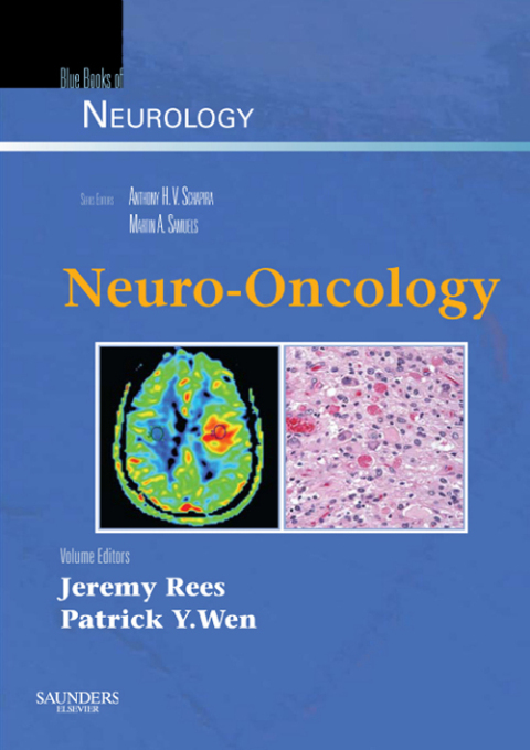 Cover image for book Neuro-Oncology