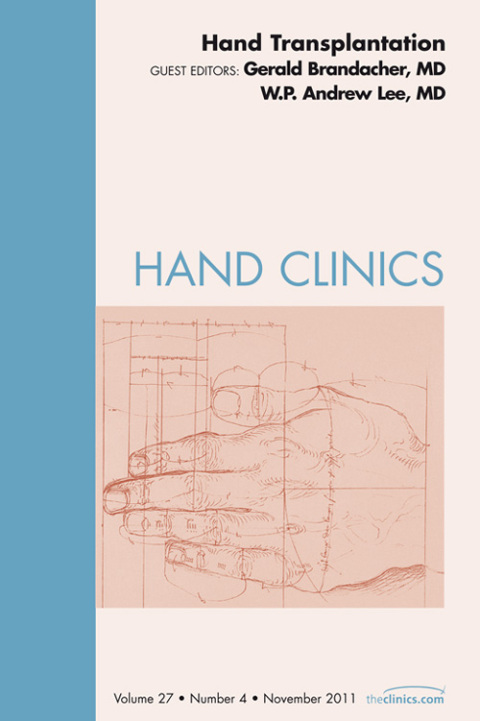 Cover image for book Hand Transplantation, An Issue of Hand Clinics