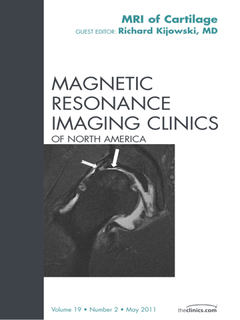 Cover image for book Cartilage Imaging, An Issue of Magnetic Resonance Imaging Clinics