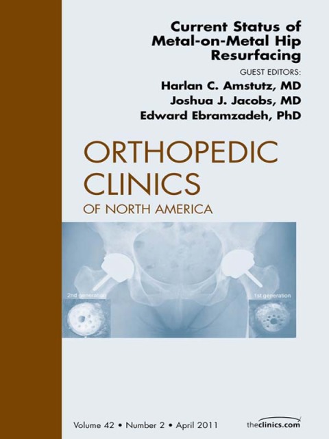 Cover image for book Current Status of Metal-on-Metal Hip Resurfacing, An Issue of Orthopedic Clinics