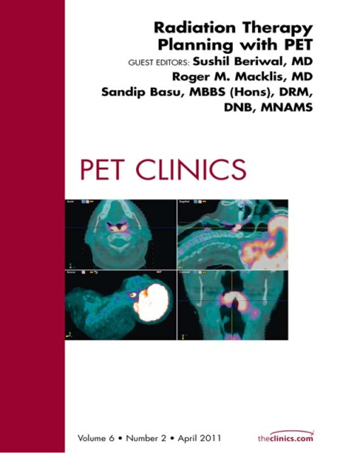 Cover image for book Radiation Therapy Planning, An Issue of PET Clinics