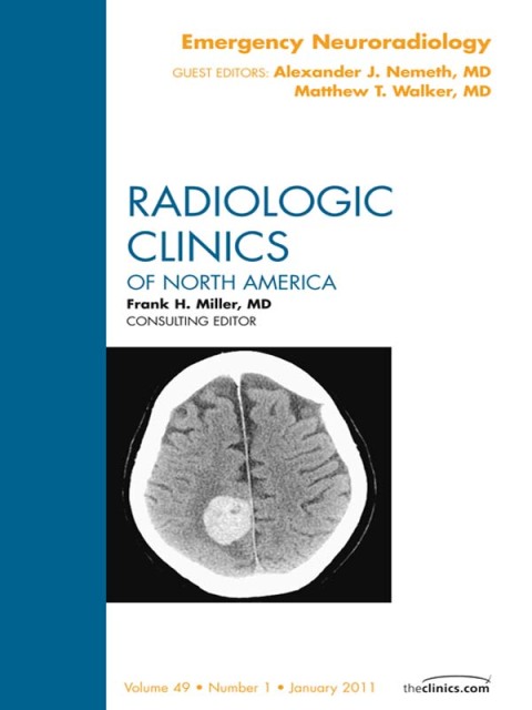 Cover image for book Emergency Neuroradiology, An Issue of Radiologic Clinics of North America
