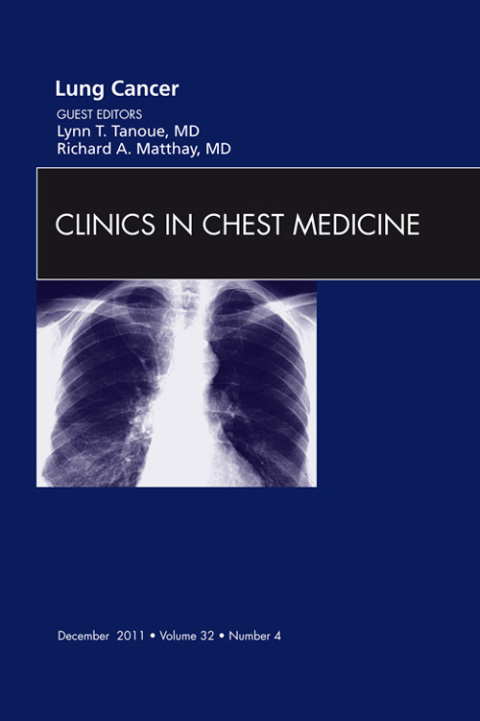 Cover image for book Lung Cancer, An Issue of Clinics in Chest Medicine