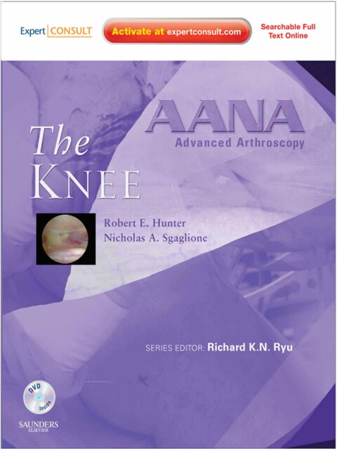 AANA Advanced Arthroscopy: The Knee 