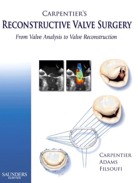 Cover image for book Carpentier's Reconstructive Valve Surgery