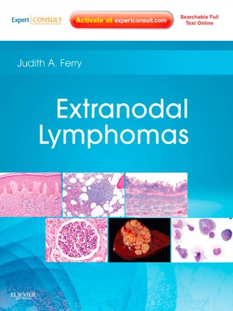 Cover image for book Extranodal Lymphomas