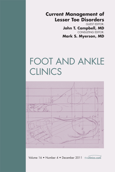 Current Management of Lesser Toe Deformities, An Issue of Foot and Ankle Clinics 