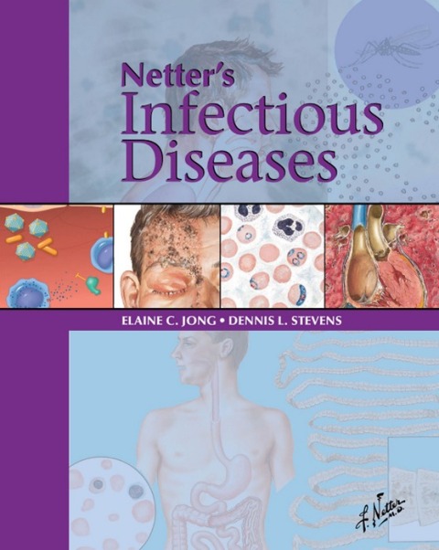 Cover image for book Netter's Infectious Diseases