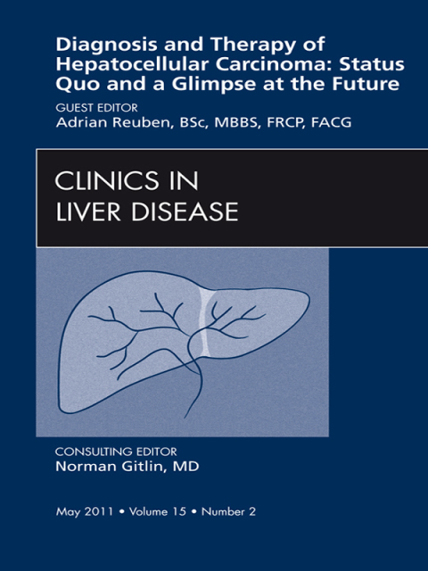 Cover image for book Hepatocellular Carcinoma, An Issue of Clinics in Liver Disease