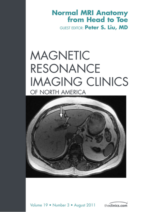 Cover image for book Normal MR Anatomy, An Issue of Magnetic Resonance Imaging Clinics
