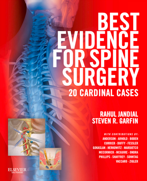 Cover image for book Best Evidence for Spine Surgery