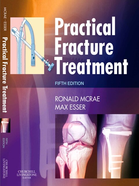 Practical Fracture Treatment 